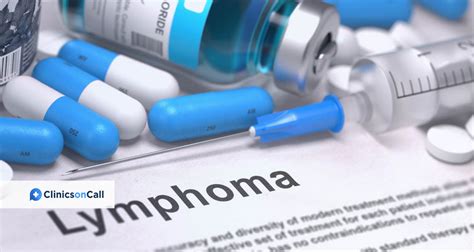 Best treatment for lymphoma cancer - Clinics on Call