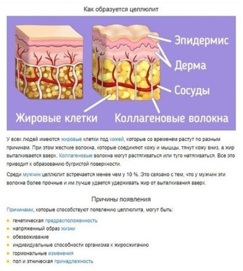 chto takoe tsellyulit  kak  obrazuetsya nauka dlya vsekh prostymi slovami
