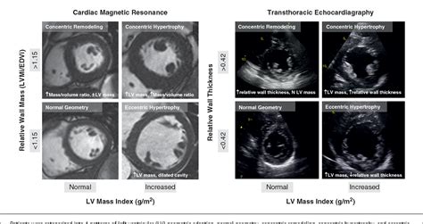 Figure From Sex Dimorphism In The Myocardial Response To Aortic Stenosis Semantic Scholar