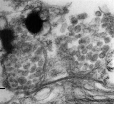 Thin section transmission electron microscope analysis of zooxanthellae ...