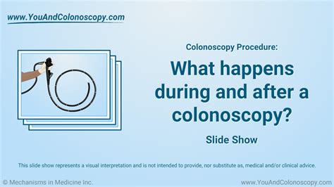 What Happens During And After A Colonoscopy