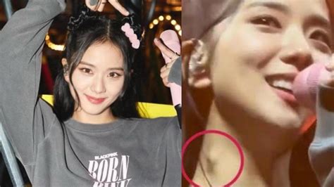 Yg Entertainment Reacts To Blackpinks Jisoos Lump On Her Neck