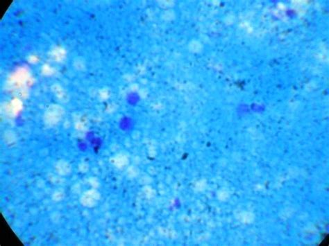 A B Somatic Cell Count In Milk Stained With Modified NewmanLampert