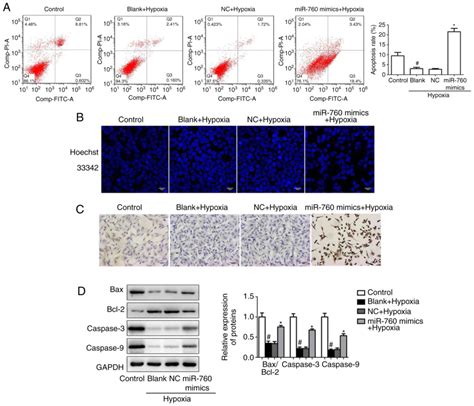 Mir‑760 Mediates Hypoxia Induced Proliferation And Apoptosis Of Human