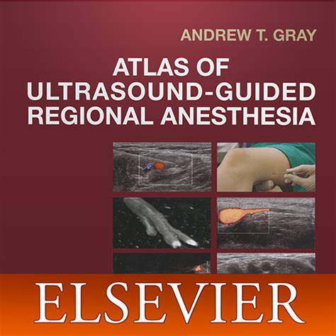 Atlas Of Ultrasound Guided Regional Anesthesia Aplicativo Na Amazon