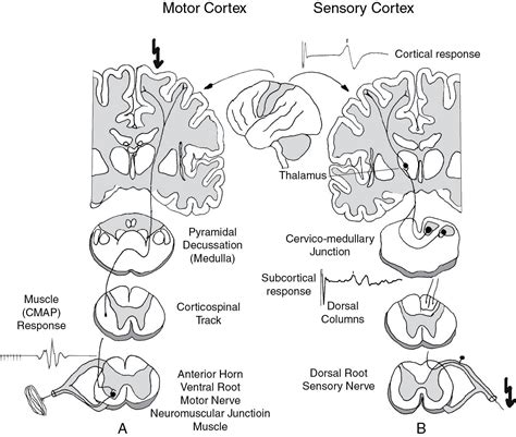 Intraoperative Neurophysiologic Monitoring During Spinal Procedures