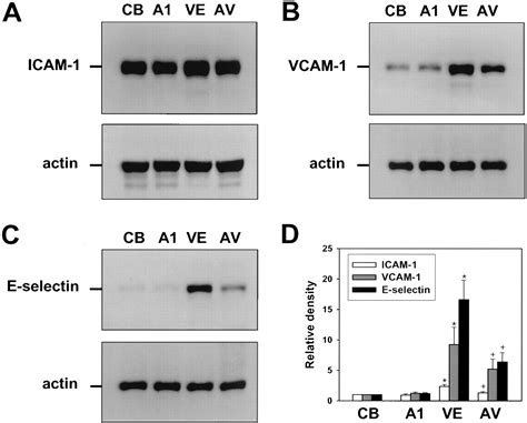 Angiopoietin Reduces Vegf Stimulated Leukocyte Adhesion To