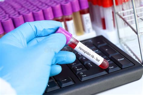 Hemoglobin Hb Test To Look For Abnormalities From Blood Blood Sample