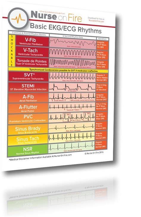 Ekg Ecg Cheat Sheet 11 Basic Rhythms Nurses Need To Know Download So You Can Recognize The