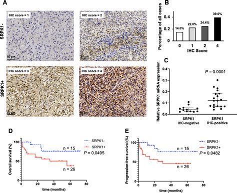 SRPK1 Is Expressed In More Than Half Of ENKTL Patients And Is