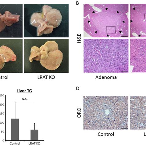 Hepatic Neoplastic Lesions And Steatosis In The Experimental Mice A Download Scientific