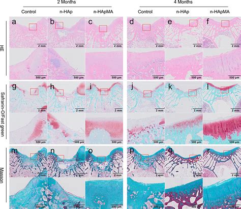 Surface-Modified Nano-Hydroxyapatite | IJN 