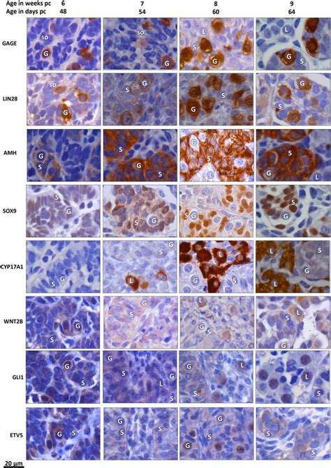 Immunohistochemical detection of prominent markers in human embryonic ...