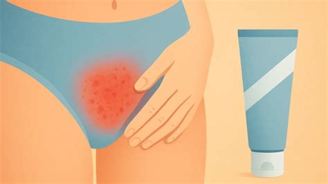 Alergia A Gilete Na Virilha - Irritações na Virilha: Causas Comuns e Pomadas Indicadas | Viaje no Detalhe