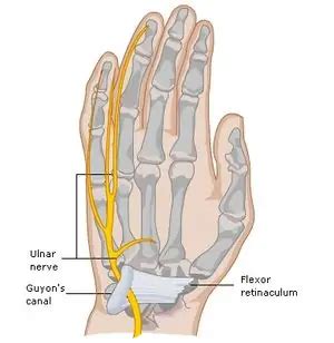 Síndrome Do Canal De Guyon Traumatologia E Ortopedia