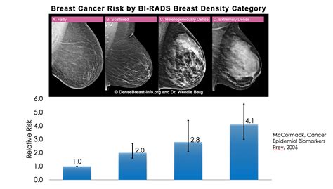 Do Dense Breasts Affect The Risk Of Developing Breast Cancer