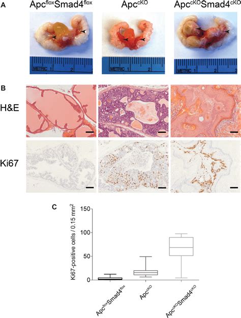 Proliferative Increases In Apc CKO Smad4 CKO Mice Compared To Apc CKO