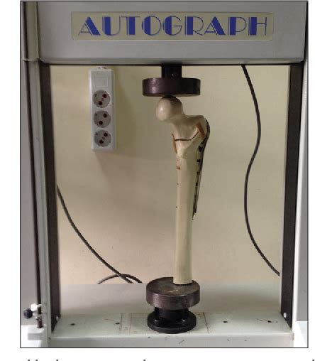 Figure 3 From A Biomechanical Comparison Of Proximal Femoral Nails And