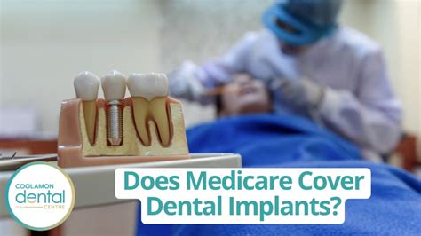 Does Medicare Cover Dental Implants