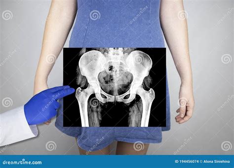 X Ray Of The Pelvic Bones Of A Woman Radiologist Examines X Ray