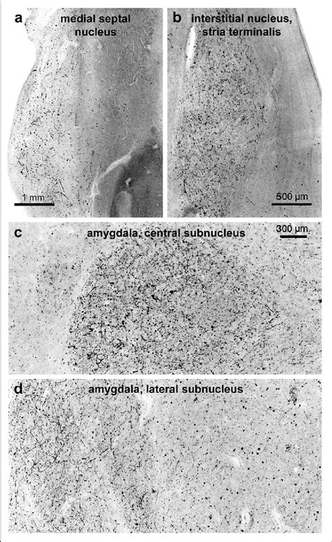 Involvement Of The Medial Septal Nucleus A Of Various Amydalar