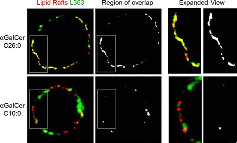 Extent Of Lipid Raft Location Of Cd1d And Cd1dαgc Complexes Confocal