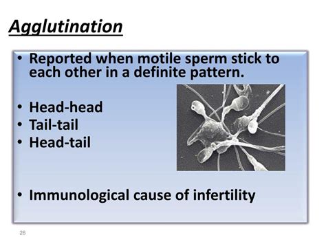 Ppt Semen Analysis Powerpoint Presentation Free Download Id1992878