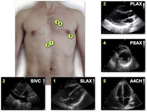 International Evidence Based Recommendations For Focused Cardiac