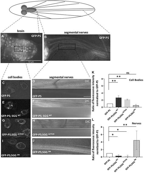 Expression Of Gsk3b Influences The Subcellular Localization Of Ps