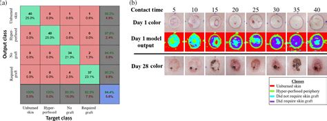 Burn wound classification model using spatial frequency-domain imaging and machine learning