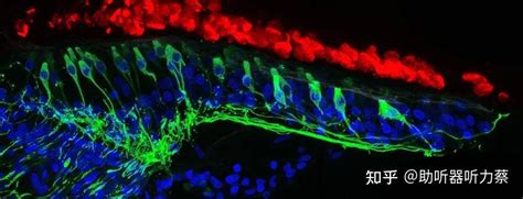 耳蜗毛细胞再生新发现 知乎