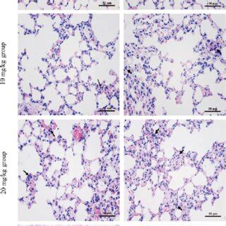 Changes Of Ros Production Levels And Cu Contents In The Lung A Ros