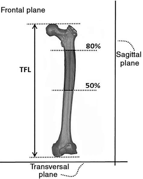 Can Your Femur Length REALLY Catch Up?