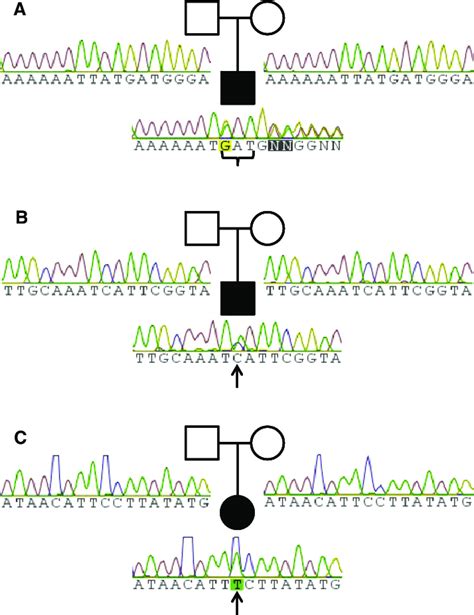 Sanger Confirmation Of Sequence Variants A The C457459del Mutation