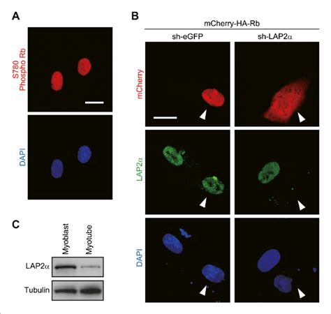 Loss Of Lap2α Affects The Cytoplasmic Translocation Of Rb A