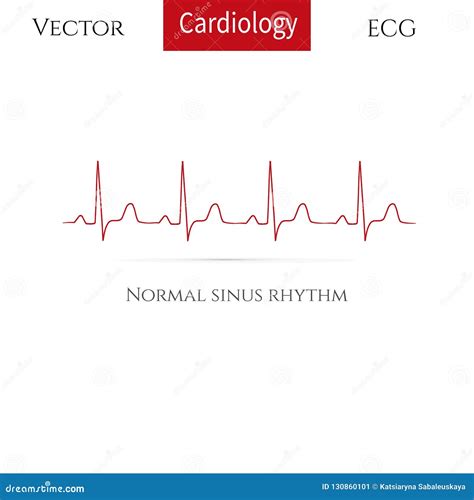 Normal Heart Rhythm Stock Illustrations – 533 Normal Heart Rhythm Stock ...