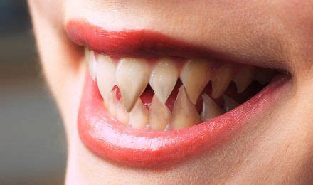 Humans May One Day Grow New Teeth Like Sharks - Social News XYZ
