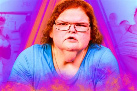 Tammy Slatons Inspirational Journey Towards Skin Removal