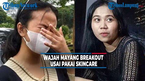 Wajah Mayang Breakout Usai Pakai Skincare Banjir Hujatan YouTube