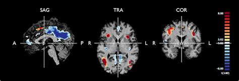 Frontiers Changes In Hemodynamic Response Function Components Reveal