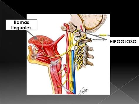 Nervio Hipogloso Par Craneal Xii Mapa Mental