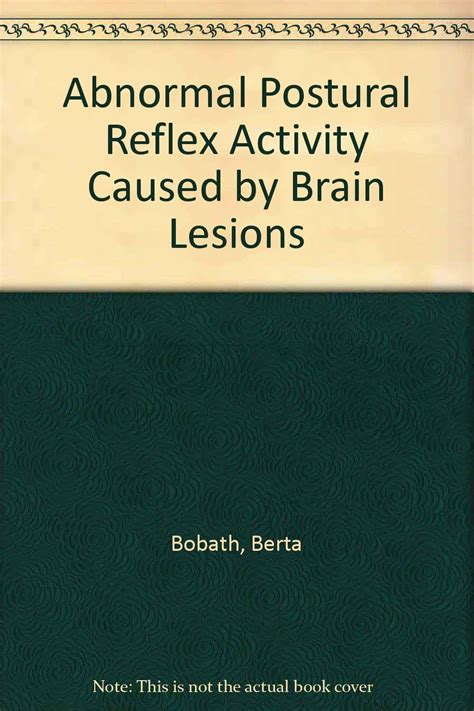 Abnormal Postural Reflex Activity Caused By Brain Lesions Bobath