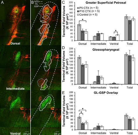 A Images Of Gl Red Tmr Labeled And Gsp Green Bda Labeled