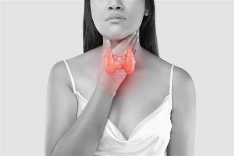 Overactive Thyroid Gland Here Are The Causes Symptoms And Common Signs Overactive Thyroid