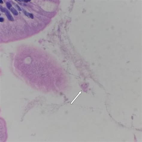 G Duodenalis Trophozoite In A Histological Section Of The Duodenum Download Scientific Diagram