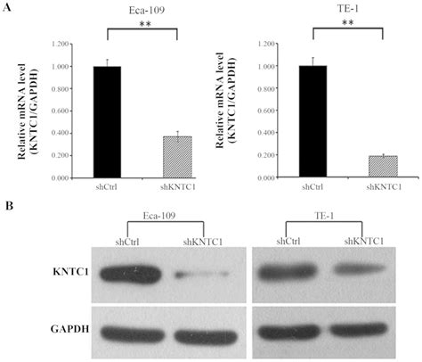 ShRNAmediated Knockdown Of KNTC1 Suppresses Cell Viability And Induces