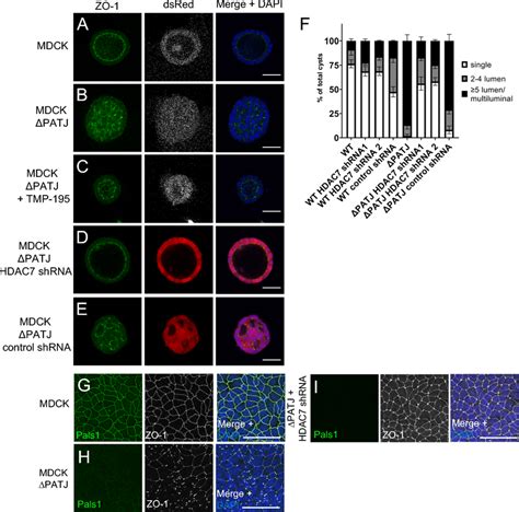 Inhibition Of HDAC7 Rescues Polarity Phenotypes Of PATJ Deficient