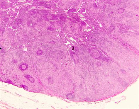 Langerhans Cells Histology