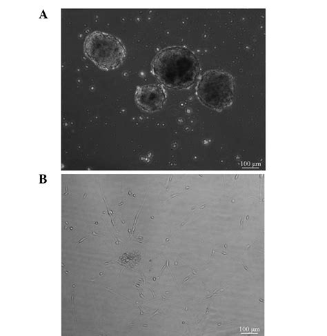 High Expression Of Vegf And Pi K In Glioma Stem Cells Provides New