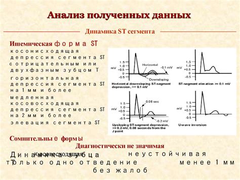 Тредмил тест - презентация онлайн
